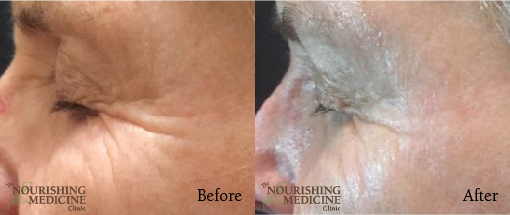 nimble_asset_PG-EYE-BA-01