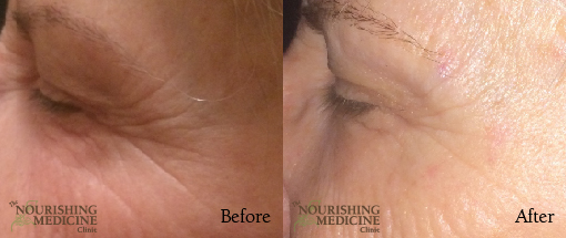 nimble_asset_PG-EYE-BA-02